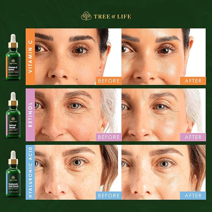 Tree of Life Beauty Facial Skin Care Set, Brightening, Firming & Hydrating Face Serums - Vitamin C, Retinol & Hyaluronic Acid for Smooth Radiant Skin, Dermatologist Tested, 1 Fl Oz (Pack of 3)