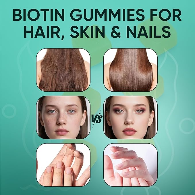 Balmbare Revive Gummies for Hair Loss - Sea Moss Gummies with Vitamin C, Vitamin E, Aloe Vera, Pearl Powder Supports Faster Hair Growth, Stronger Nails, Extra Strength - 60 Count (1)