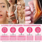 Multi Collagen Peptides Powder, 1 lb Unflavored Hydrolyzed Collagen Types I, II, III, V, X，16 oz (41 Servings)-Hyaluronic Acid Power,Grass Fed Collagen Supplements for Women and Men, Non GMO