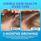Biotin Gummies 10,000mcg with Collagen - 23-in-1 Hair Growth Gummies for Women & Men - Hair Skin and Nails Gummies with Keratin & Saw Palmetto - Sugar Free Non-GMO, Blueberry, 180 Count