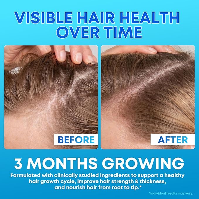 Biotin Gummies 10,000mcg with Collagen - 23-in-1 Hair Growth Gummies for Women & Men - Hair Skin and Nails Gummies with Keratin & Saw Palmetto - Sugar Free Non-GMO, Blueberry, 180 Count