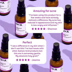 Q+A Azelaic Acid Balancing Serum (30ml), Natural Face Serum with Zinc PCA and Antioxidant Super Grains, Fragrance Free Skincare, Smoothes Skin