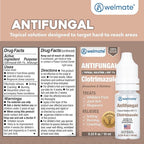 WELMATE Clotrimazole 1% Antifungal Topical Solution, 2 Pack 0.33 fl oz Each - Athlete's Foot, Jock Itch, Ringworm Treatment, Greaseless Non-Staining, Relieves Itchy Cracked Skin