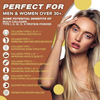 Zammex Multi Collagen Protein Powder, Type I & III & V & X, Hydrolyzed Collagen Peptides for Women & Men, Supports Hair and Skin, Gut Health, 41 Servings, Chocolate