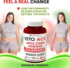 Keto ACV Gummies Advanced Weight Loss - ACV Keto Gummies for Weight Loss for Women and Men - Keto Gummies Supplement - Detox & Cleanse, Digestion - Apple Cider Vinegar - Apple Flavor