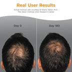 Viviscal Men's Hair Growth Supplements for Thicker Fuller Hair, Clinically Proven Collagen Complex, 180 Tablets 3 Month Supply
