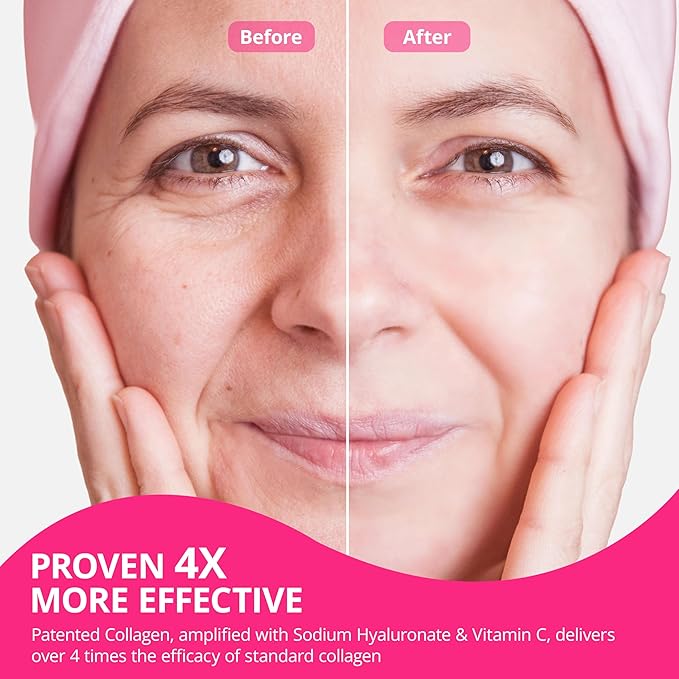 Collagen Powder for Women, Collagen Peptides Powder with Probiotics, Prebiotic Collagen Protein for Skin, Hair, Bone & Joint | 16-in-1 Sugar-Free Formula, Unflavored