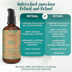 SOENA Retinol Serum for Face – The Best Retinol Form (Retinal) + 7 Active Ingredients = Hyaluronic Acid, Vitamin C, Niacinamide | Anti Aging Wrinkle & Fine Line Treatment – Made in Germany – 1.7 Fl Oz