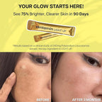 Light Up – Antioxidant Skin-Brightening Supplement with Vitamin C, Plant-Based Extracts & Hydrating Support – Lemon Green Tea Flavor – for Even Tone, Dark Spot Reduction & Glow – 30 Sachets