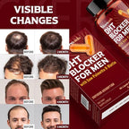 DHT Blocker for Men | Hair Growth Vitamins Supplement with Saw Palmetto & Biotin - Hair Regrowth - Natural Hair Loss Supplements Liquid-Filled - Proprietary Herbal Blends (90 Capsules)