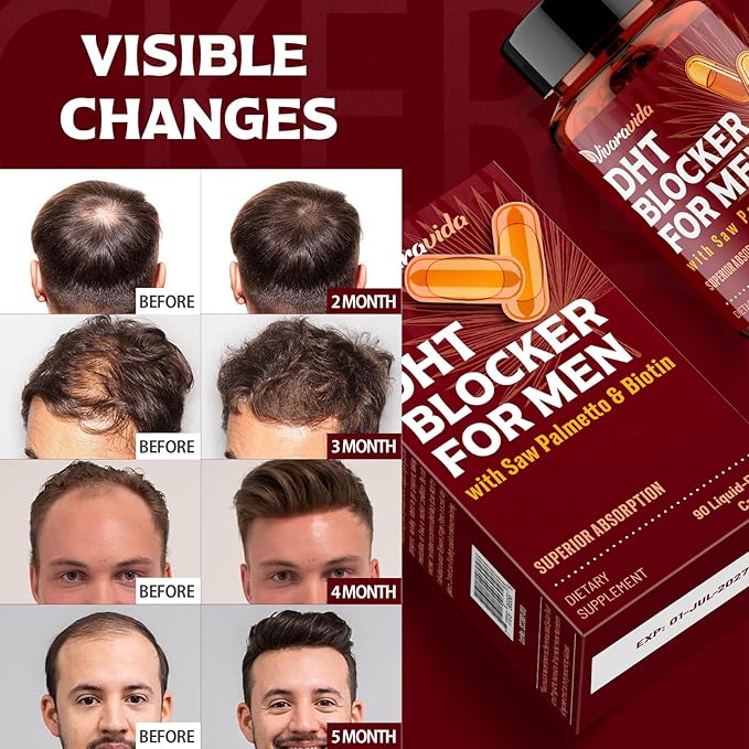 DHT Blocker for Men | Hair Growth Vitamins Supplement with Saw Palmetto & Biotin - Hair Regrowth - Natural Hair Loss Supplements Liquid-Filled - Proprietary Herbal Blends (180 Capsules)