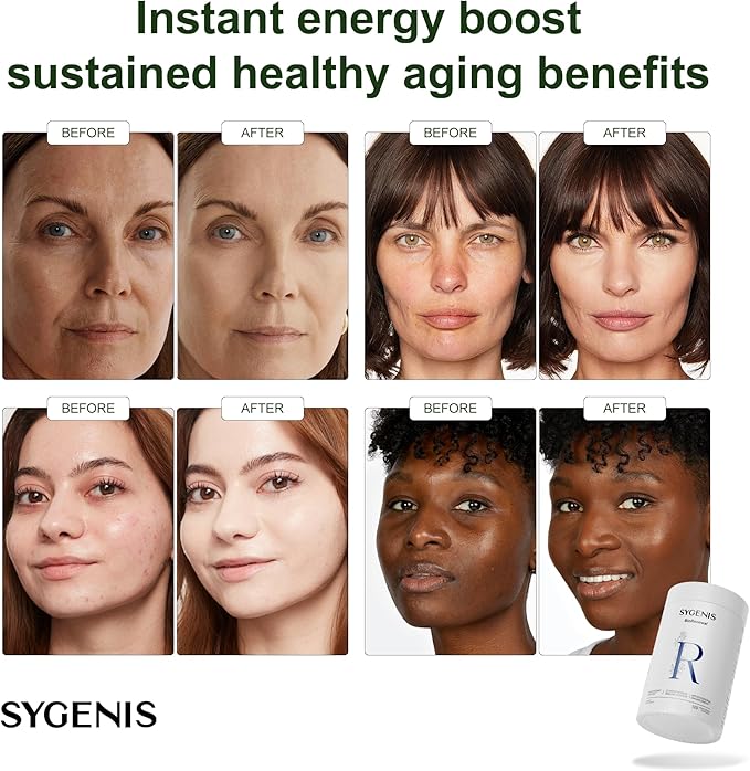 Longevity Mix for Anti Aging, Energy Supplements for Women and Men, Antioxidant Nutritional Supplements for Brain, Focus, Mood & Immune Support, Nad Supplement Vegan & Gluten Free 120 Capsules