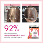 Biotin Gummies for Hair, Skin & Nails. 5,000 mcg High Potency Vegan Vitamins for Faster Hair Growth, Stronger Nails & Healthy Skin. with Vitamins C & E, 30 Gummies