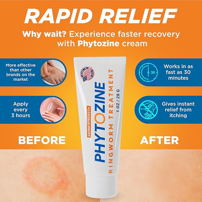 Anti Fungal Cream For Skin With 1% Tolnaftate - Ringworm Treatment For Humans - Effective Athletes Foot Treatment Cream - Nourished by 15+ Natural Oils & Botanicals - Made in USA - 1 oz