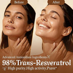 Resveratrol Supplement 98% High Purity Trans-Resveratrol Complex with Collagen Peptides & Hyaluronic Acid,Quercetin,Antioxidant Support for Skin & Beauty,Immune Health,Gluten-Free,60 Capsules