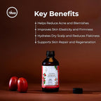 My Ace Rosehip Seed Carrier Oil | 100% Pure Cold Pressed Unrefined Oil for Face & Skin Care, Hair & Body Massage, Anti-Aging & Moisturizing – 4 fl oz