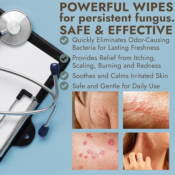 Body Wipes for Men & Women | Cleansing Body Wipes for Wrestling, Combat, Gym, Camping I Medicated with 1% Tolnaftate, Tea Tree Oil | Treats Ringworm, Jock Itch, Athlete's Foot | 40 Wipes (pack of 2)