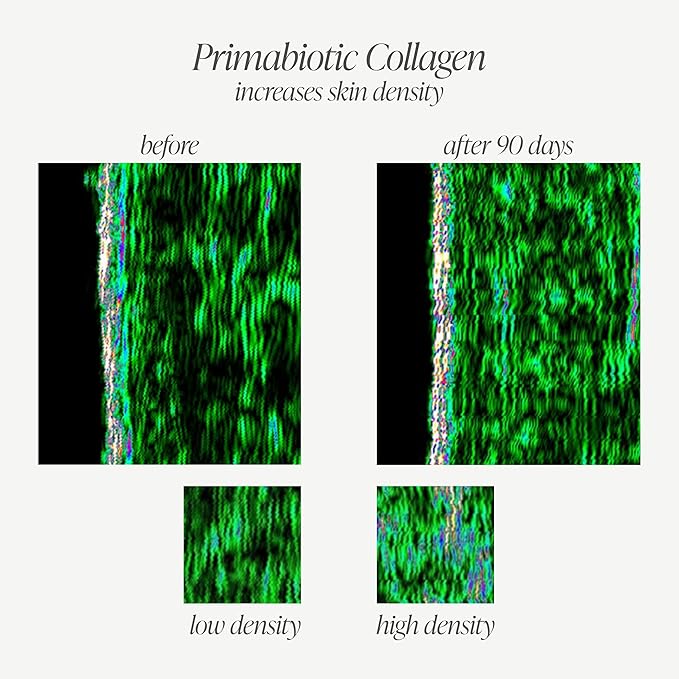 PRIMABIOTIC Liquid Collagen - High Collagen Content [10,000 Mg] Per Serving - Hydrolyzed Collagen and 12 Vitamins - Gluten Free- 900 Ml - Pack of 30 Bottles x 30 Ml (1)