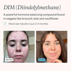 MDacne DIM Skin Clearing Supplements (30 Vegan Capsules) - for Acne Treatment, Estrogen Balance, Hormone Menopause Relief & Bodybuilding, Cruciferous Extract & Bioperine (30 Count (Pack of 1))