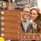 Zammex Multi Collagen Protein Powder, Type I & III & V & X, Hydrolyzed Collagen Peptides for Women & Men, Supports Hair and Skin, Gut Health, 41 Servings, Chocolate