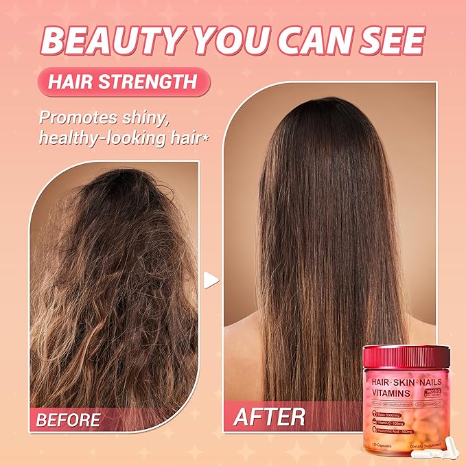 Hair Skin and Nails Vitamins – Biotin, Hyaluronic Acid, Calcium AKG, Vitamin C & Vitamin D3 K2 – Support Healthy Hair Growth, Strong Nails & Radiant Skin - 120 Capsules (1 Pack)